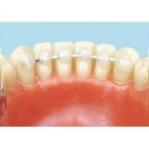 Alambre Trenzado Plano Para Splinting